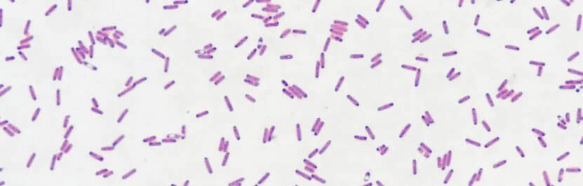 Bakterie Bacillus cereus