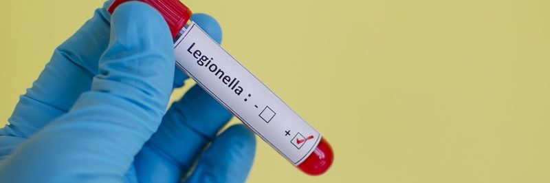 Test na Legionella