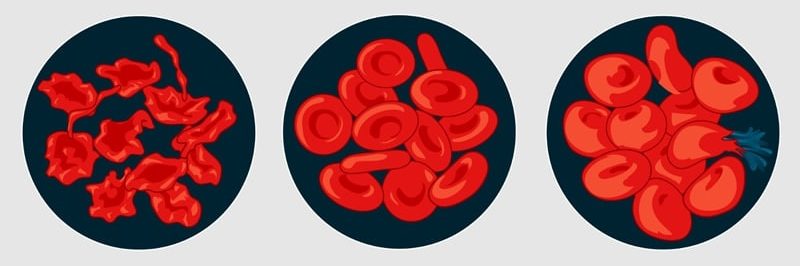 Vliv osmotického tlaku na lidské červené krvinky